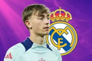 EGD Real Madrid